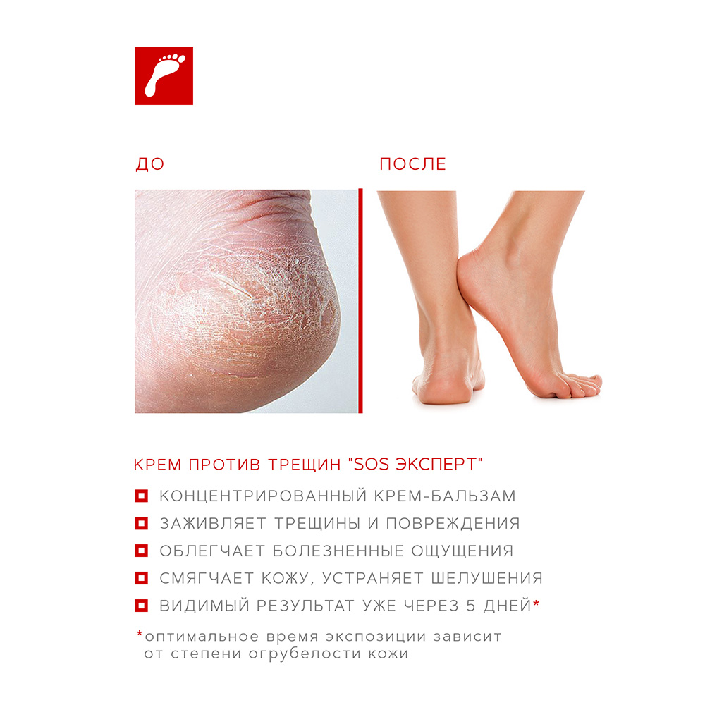Профессиональный ультра восстанавливающий крем для ног против трещин "SOS эксперт", 100 мл.